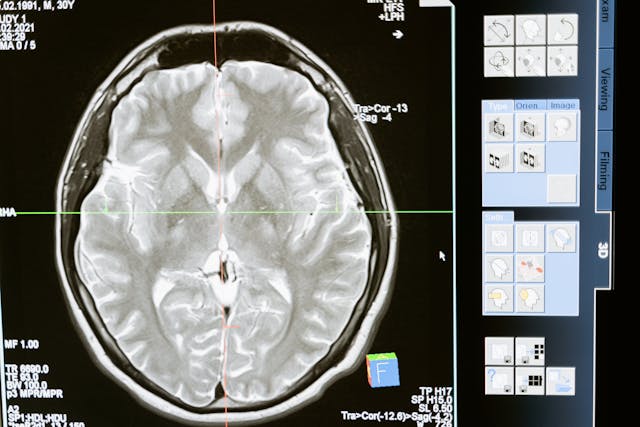 Audiobooks and the Brain